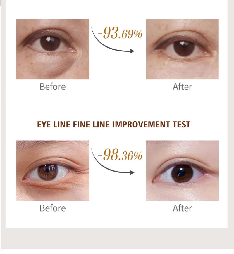Stick Crème Contour des Yeux à la Caféine – Anti-Poches, Anti-Cernes, Hydratant et Éclaircissant – Regard Frais et Défini