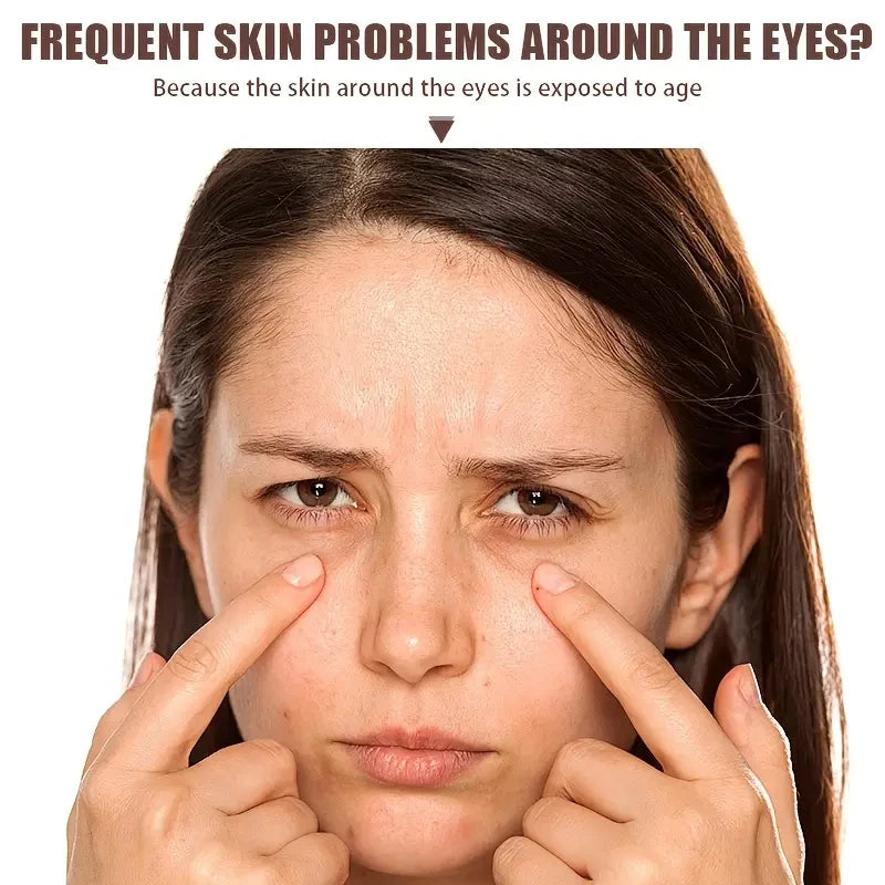 Crème Contour des Yeux au Venin d’Abeille et Caféine – Nourrit et Raffermit Profondément – Avec Aloe Vera et Avocat – Sans Alcool – 20g – Tous Types de Peau