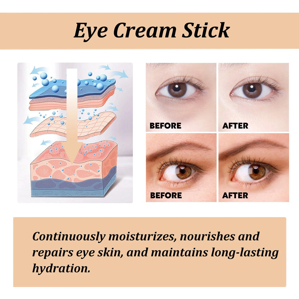 Stick Crème Contour des Yeux à la Bave d'Escargot – Collagène – Estompe les Rides et Ridules – Éclaircit les Cernes – Raffermit – Réduit les Poches et les Gonflements – Hydratant et Nourrissant